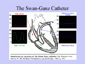 Hospital agrees to develop training program regarding proper insertion of swan ganz catheters